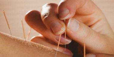 Jump Starting Your Low Libido With Acupuncture