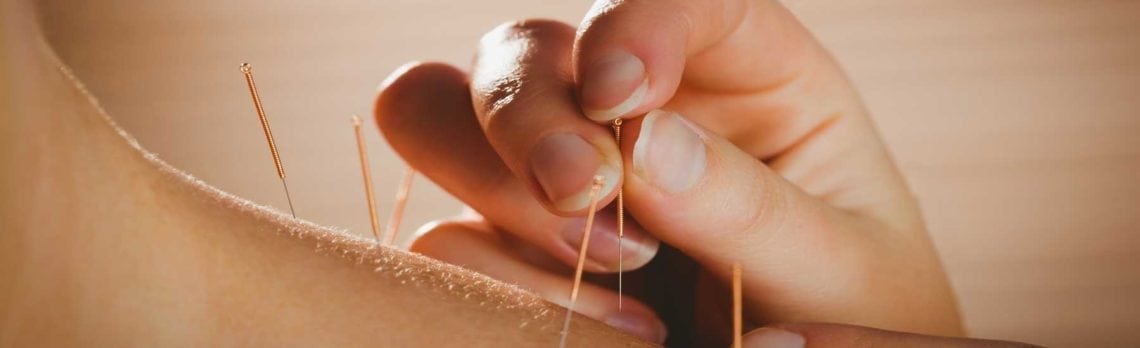 Jump Starting Your Low Libido With Acupuncture