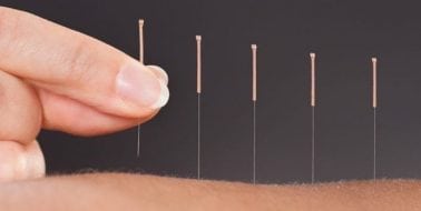 The Science Behind Using Acupuncture for Low Libido and Sexual Dysfunction