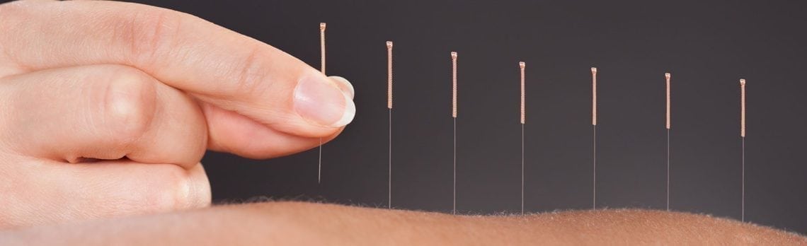 The Science Behind Using Acupuncture for Low Libido and Sexual Dysfunction