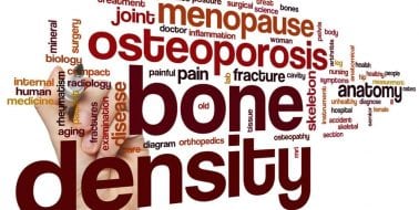 Age-Related Bone Loss in Women: The Menopause-Osteoporosis Connection